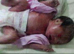 陕西试管婴儿费用大公开，能医保报销吗？