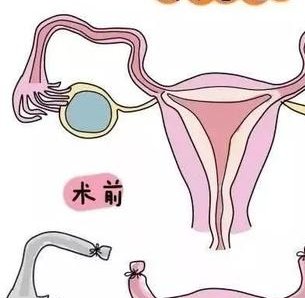 2026福州三代试管婴儿总共需要多少钱？只需考虑两个方面